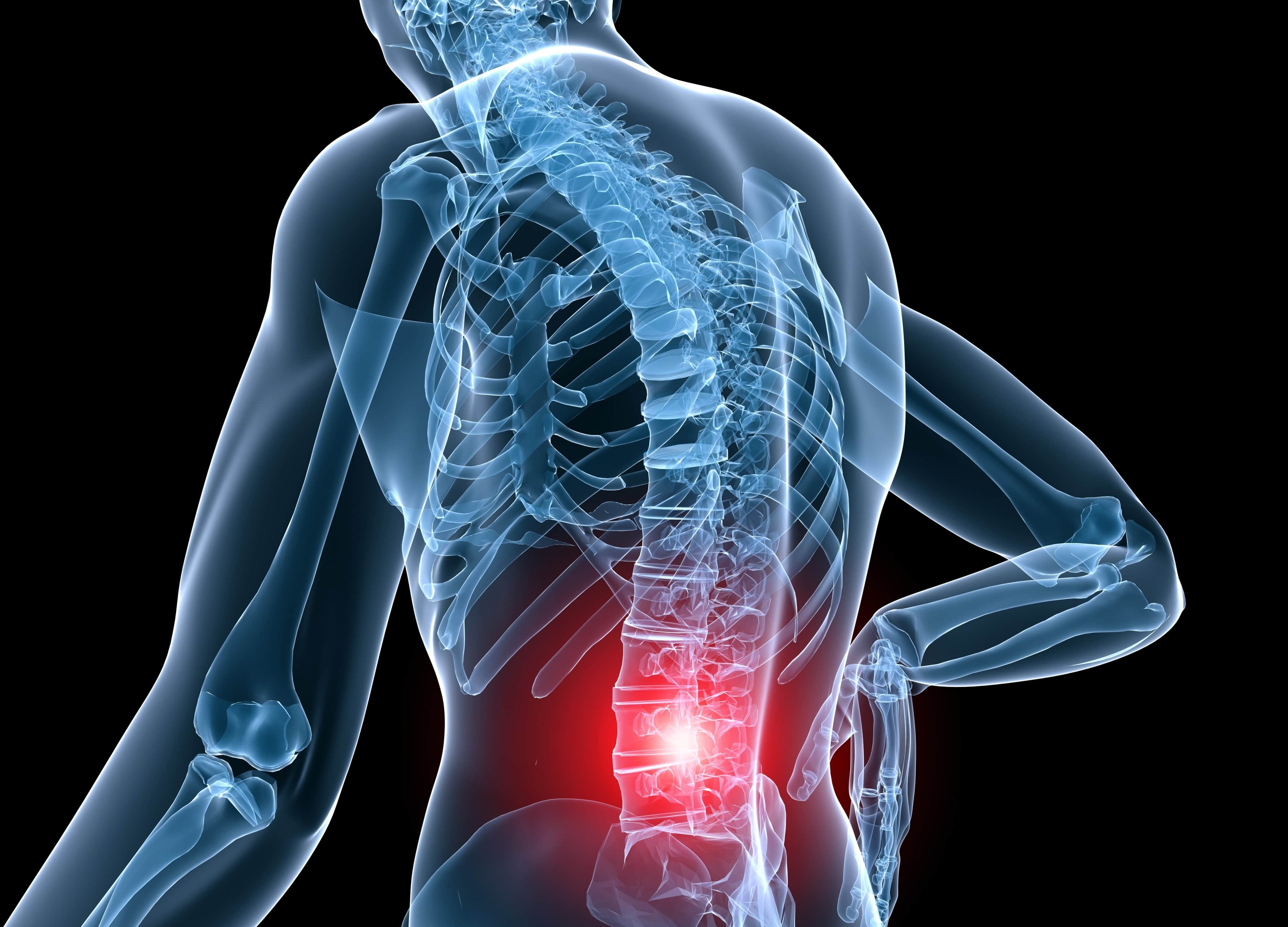Chronic low back pain: Effective Long-Term Solutions